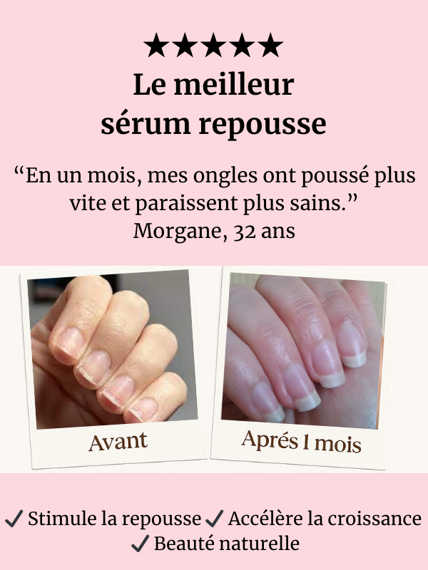 ✨ Sérum Repousse Yadéïa